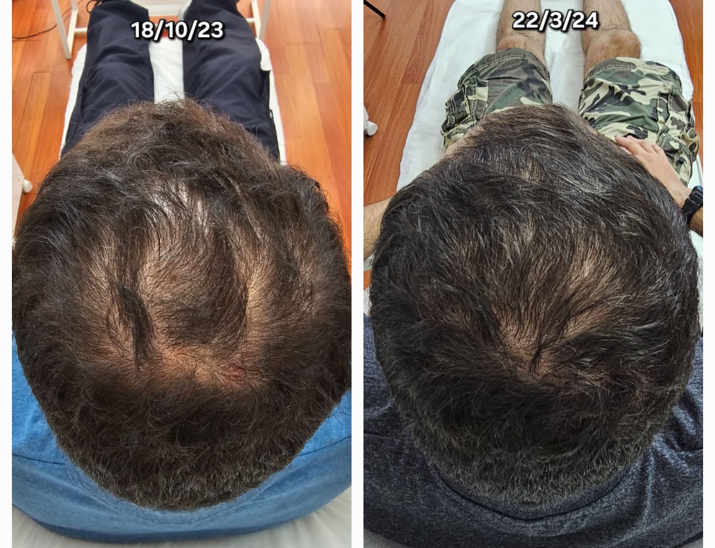 Resultados Naturales